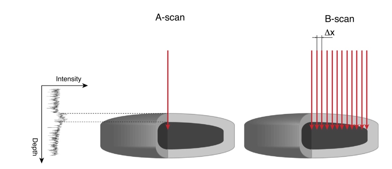 A and B Scan of optical tomography