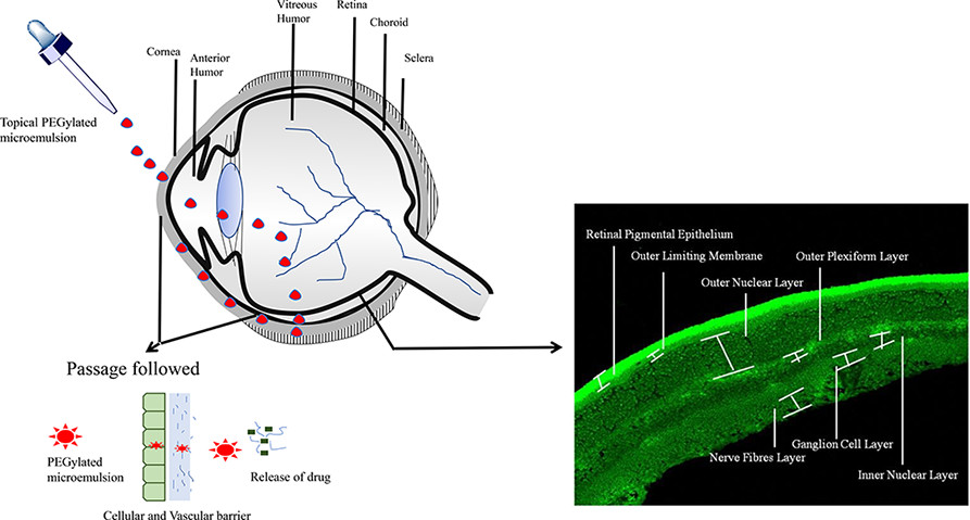 Triamcinolone Acetonide-Loaded PEGylated Microemulsion for the Posterior Segment of Eye