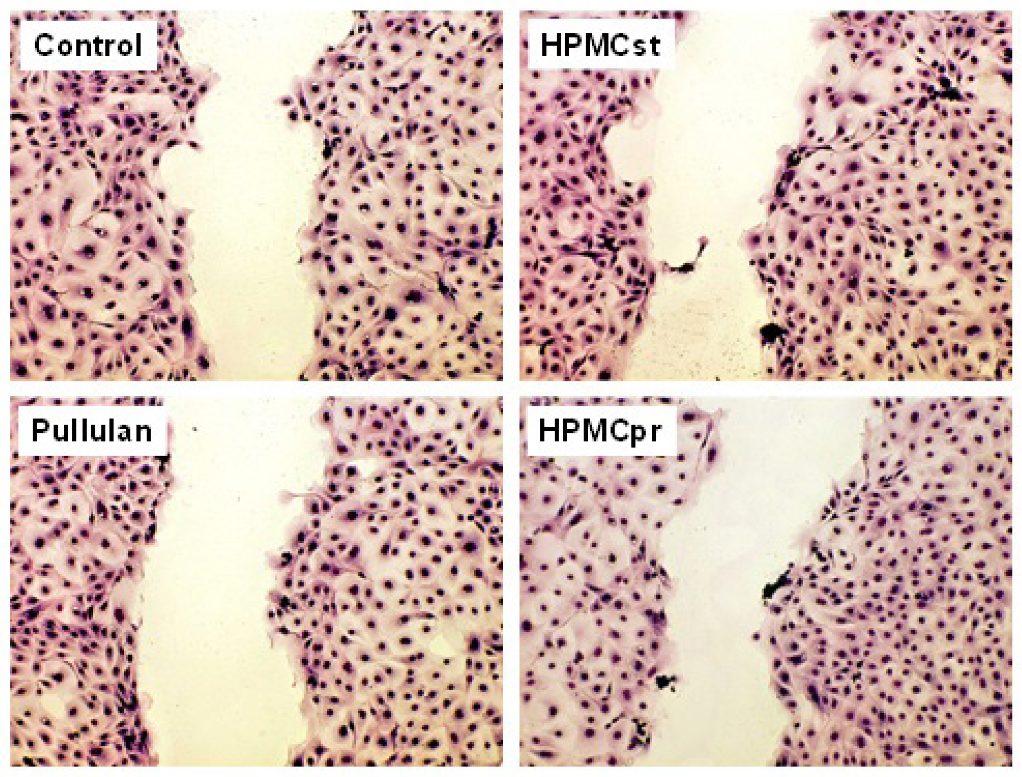 Wound healing process of intestinal epithelial cells (IPEC-J2) by colonization of a cell-free space within 24 hours at a dilution of 1:2.5 (= 1,600 μg/ml) for the different capsule solutions. Fixed and stained samples were photographed using an Olympus IX-50 inverted microscope with an Olympus 10x planachromate and an Olympus E-10 digital camera at 4-megapixel resolution. HPMCst = market standard HPMC capsules; HPMCpr = polyethylene glycol and carrageen free capsules.