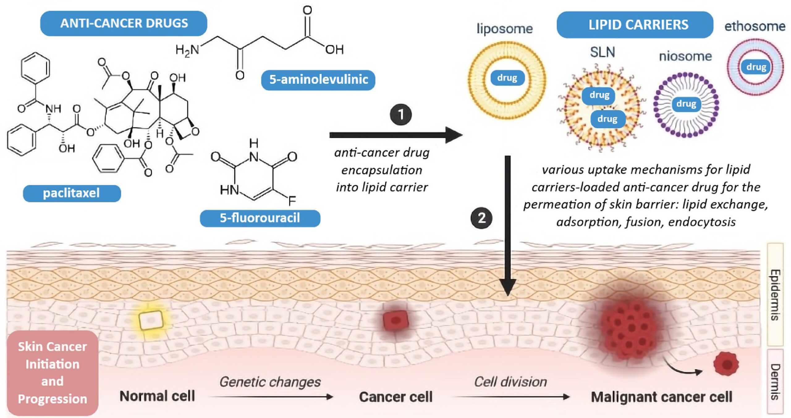 Melanoma Skin Cancer Diagram