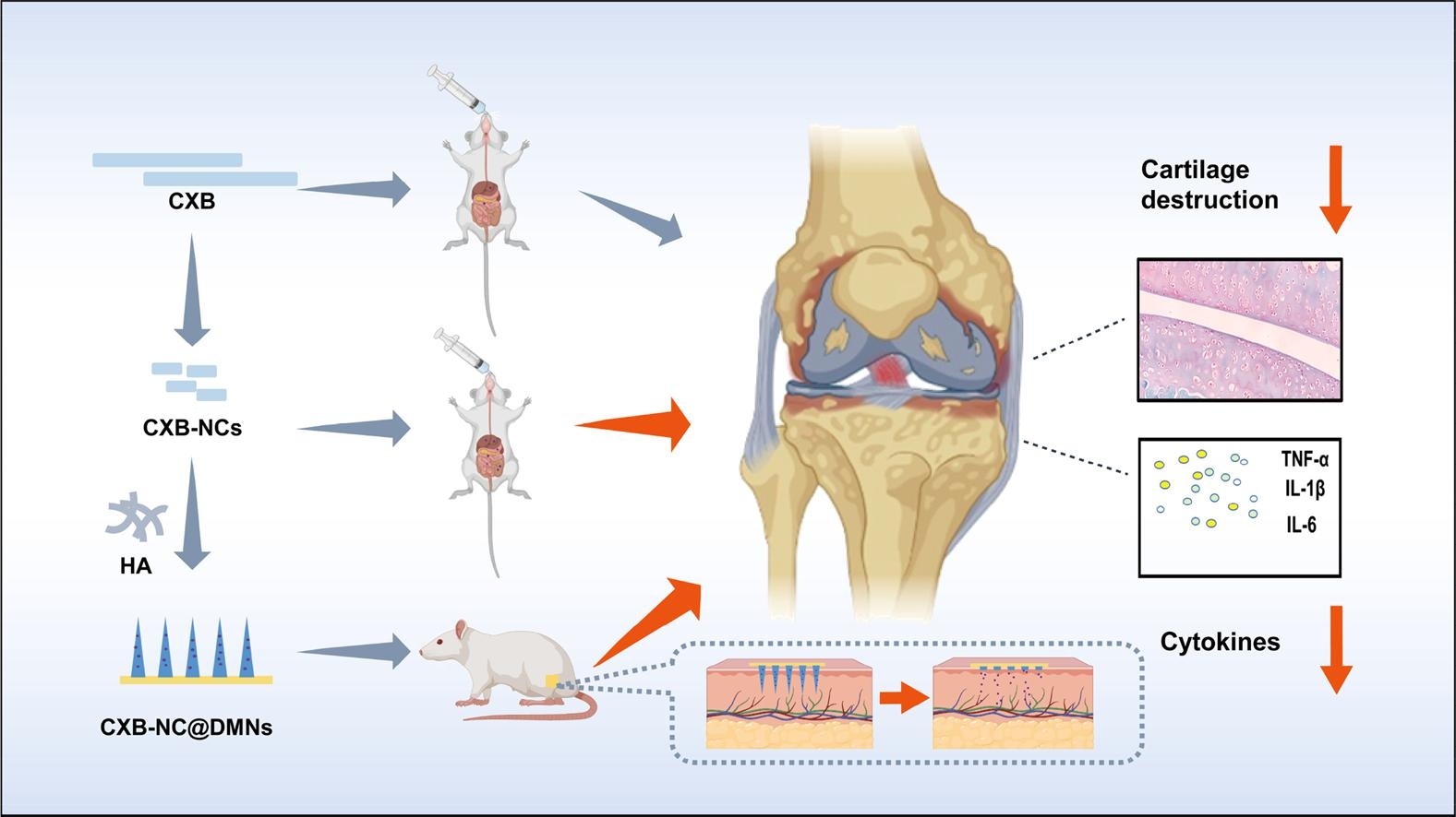 Celecoxib nanocrystal-loaded dissolving microneedles with highly efficient for osteoarthritis treatment