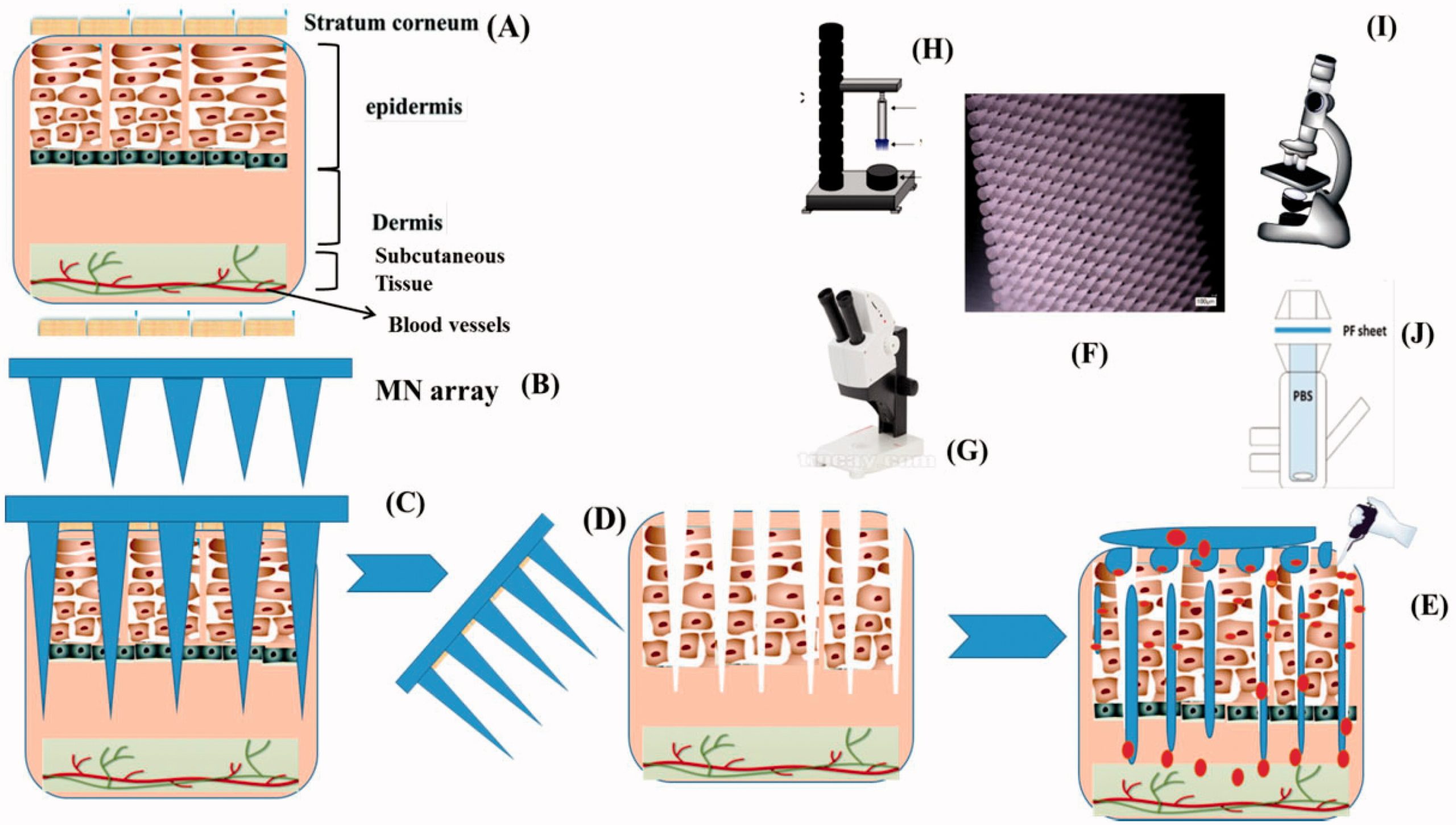 Microneedles assisted controlled and improved transdermal delivery of high molecular drugs via in situ forming depot thermoresponsive poloxamers gels in skin microchannels
