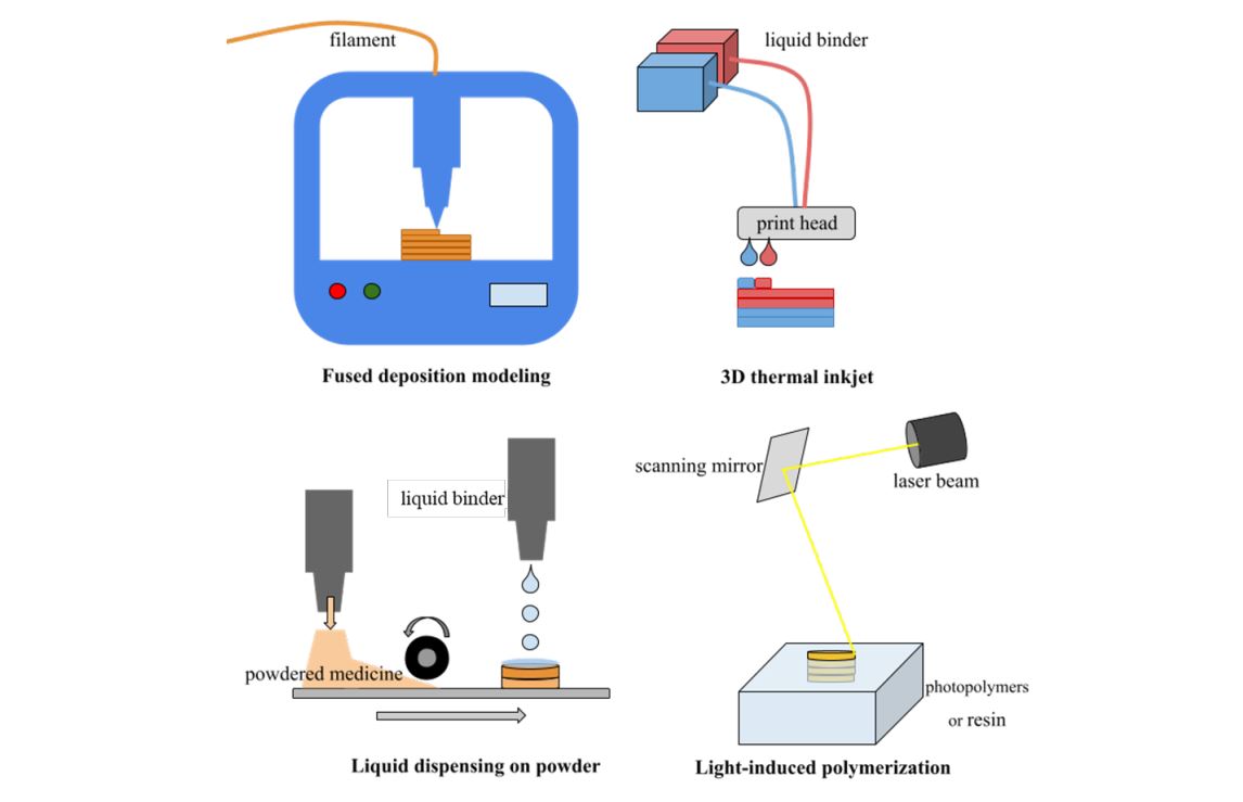 Recent advances in 3D printing for floating drug delivery platforms