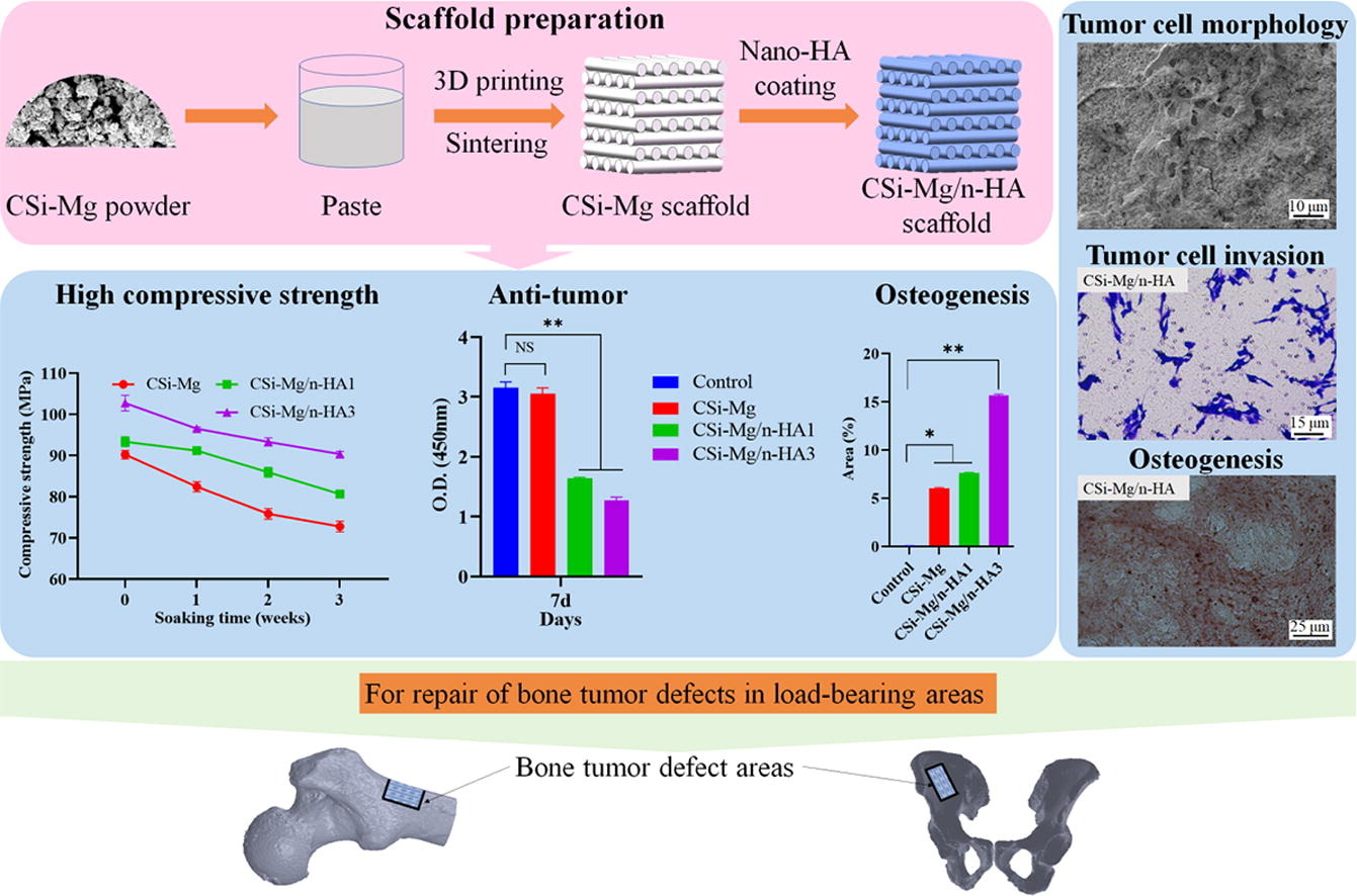 3D-printed magnesium-doped wollastonite/nano-hydroxyapatite bioceramic scaffolds with high strength and anti-tumor property