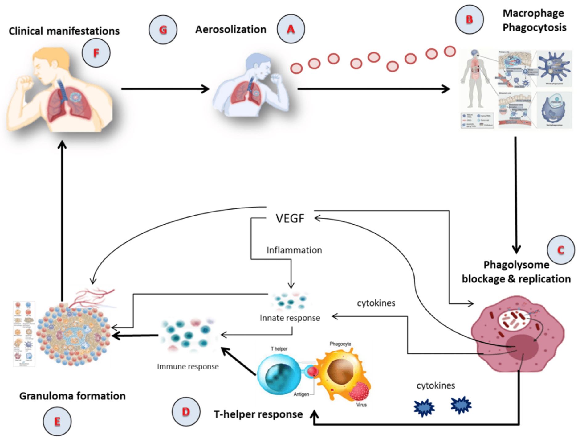 Nanocarriers in Tuberculosis Treatment: Challenges and Delivery Strategies