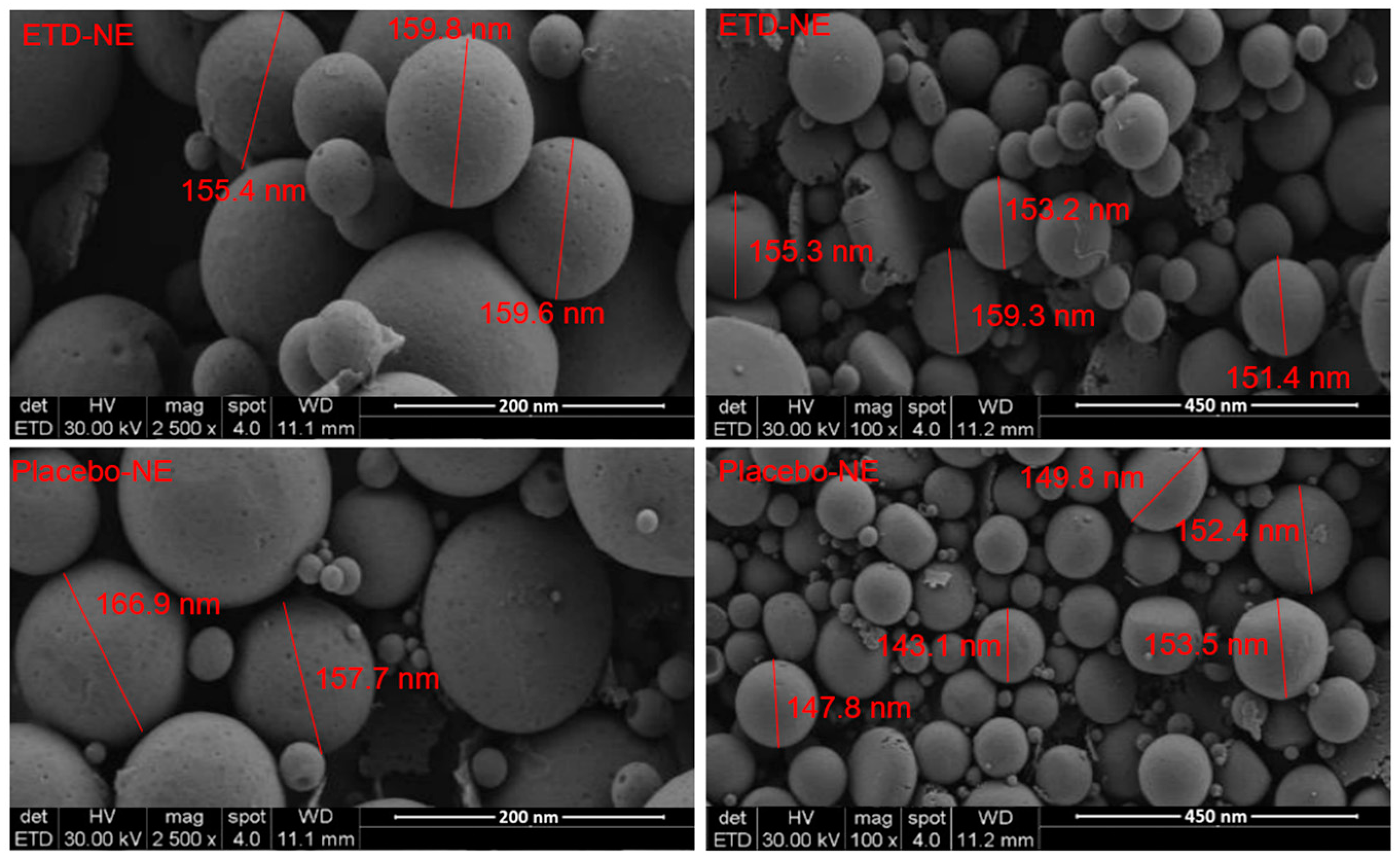 Nanoemulsions as a Promising Carrier for Topical Delivery of Etodolac: Formulation Development and Characterization