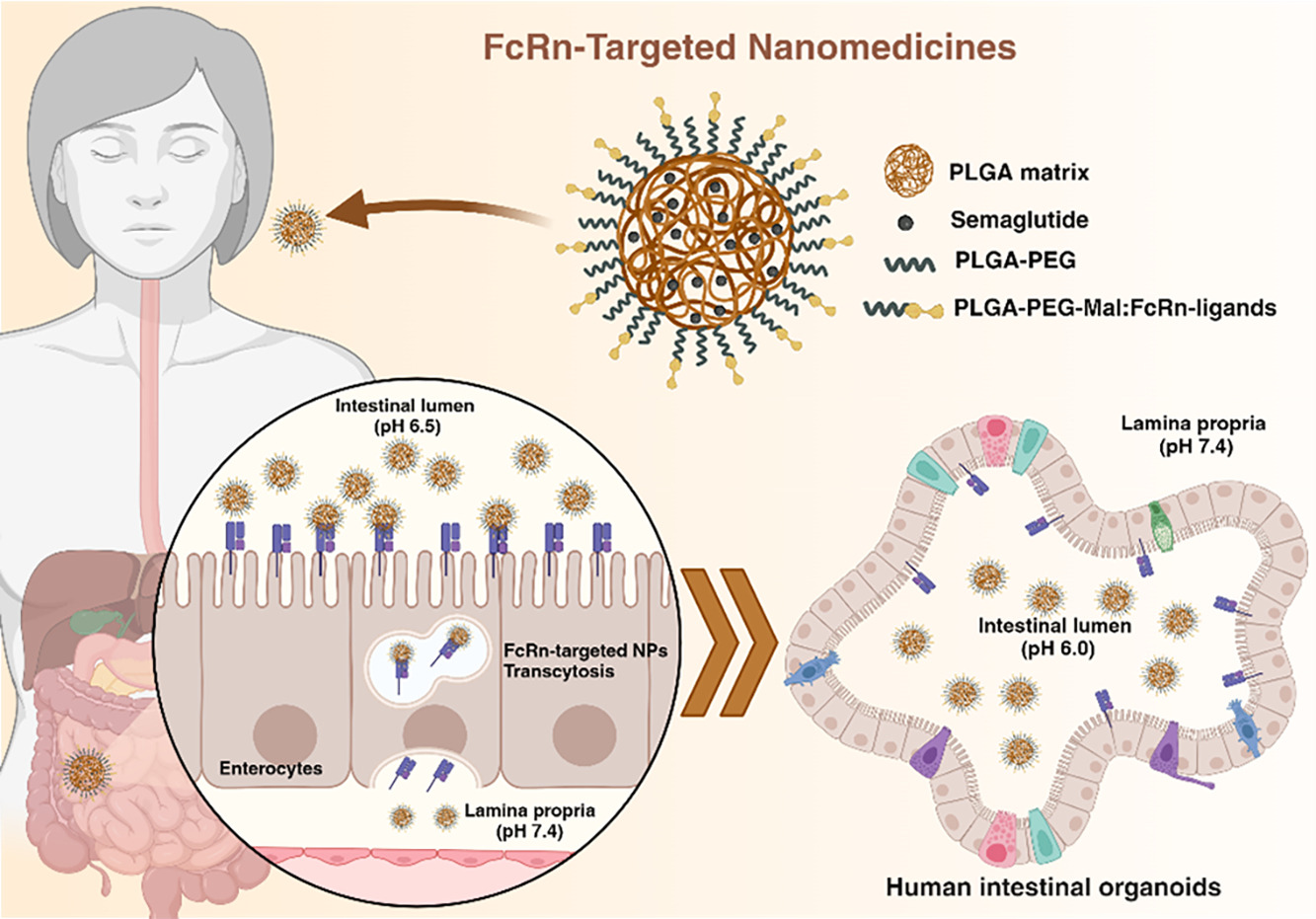 Nanoparticles targeting the intestinal Fc receptor enhance intestinal cellular trafficking of semaglutide