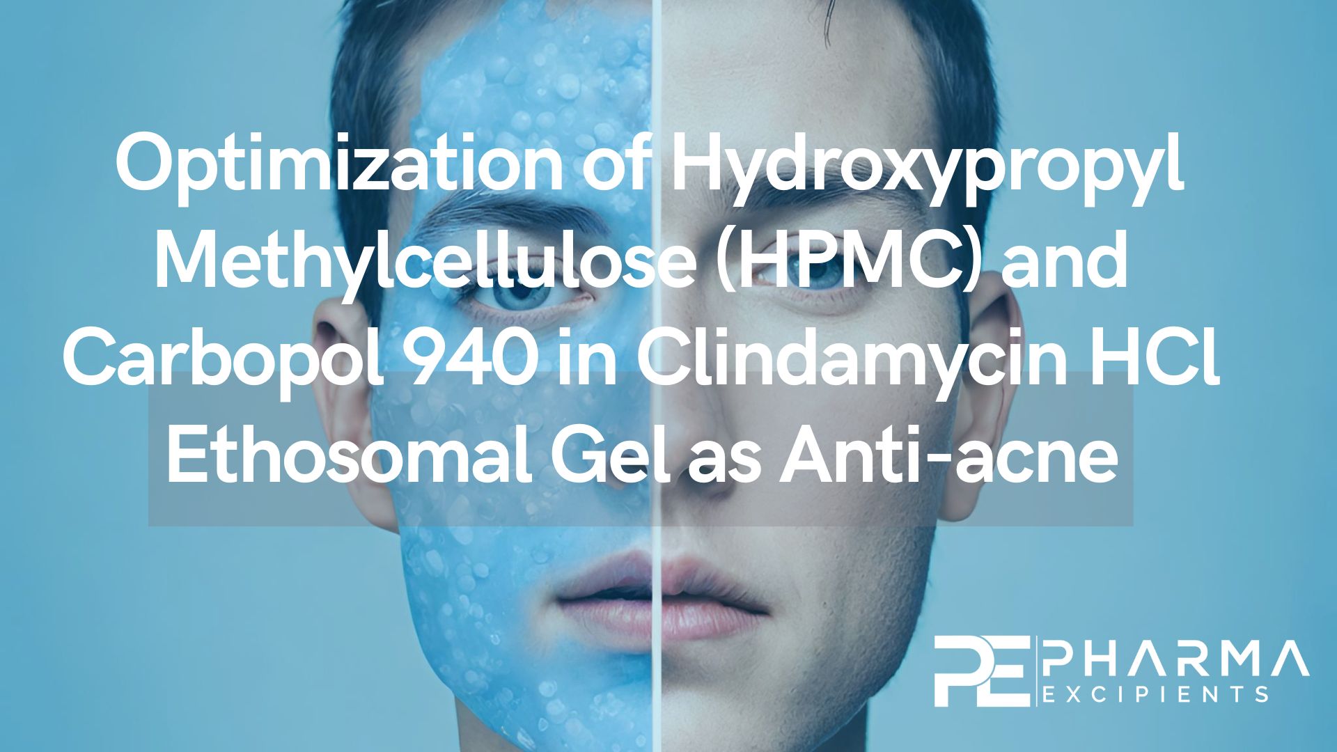 Optimization of Hydroxypropyl Methylcellulose (HPMC) and Carbopol 940 in Clindamycin HCl Ethosomal Gel as Anti-acne