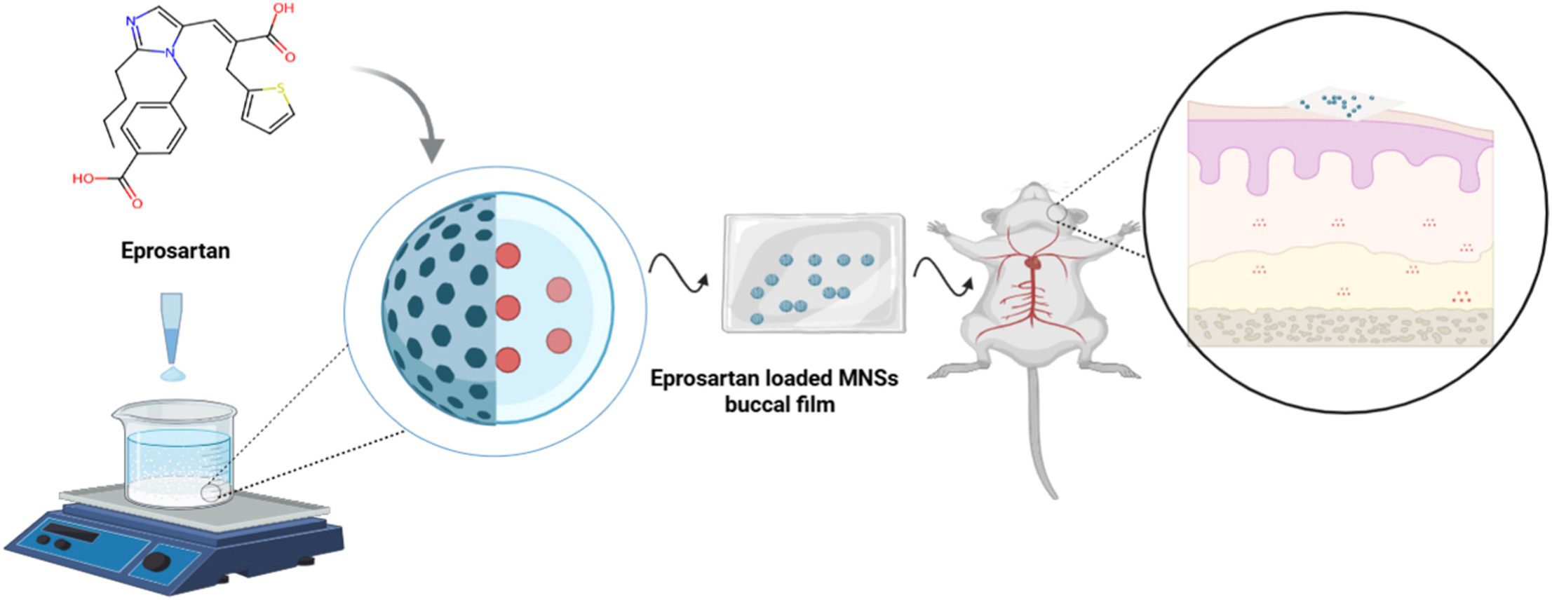 Eprosartan loaded mesoporous silica nanoparticles embedded in mucoadhesive buccal films